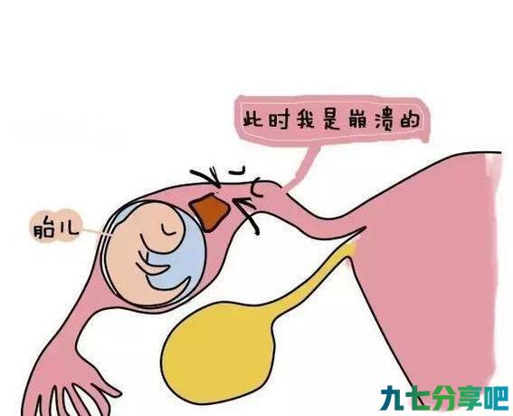 为什么宫外孕的女性越来越多，这几点原因，跟男人脱不了关系！